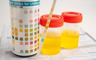 Jaki pojemnik na badanie ogólne moczu wybrać do laboratorium?