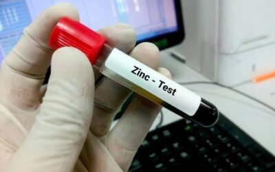 Badanie FT4 jak się przygotować do wizyty w laboratorium?