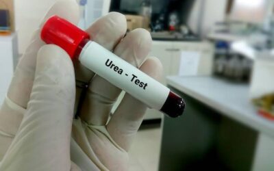 Badanie TSH kiedy wynik jest najbardziej miarodajny?