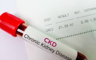 Jaki powinien być poziom TSH w badaniach tarczycy?