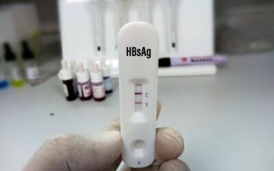 Jak zbadać hormony tarczycy i kiedy warto to zrobić?