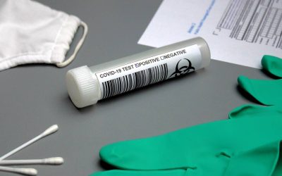 Hashimoto badania jakie warto wykonać przy podejrzeniu choroby